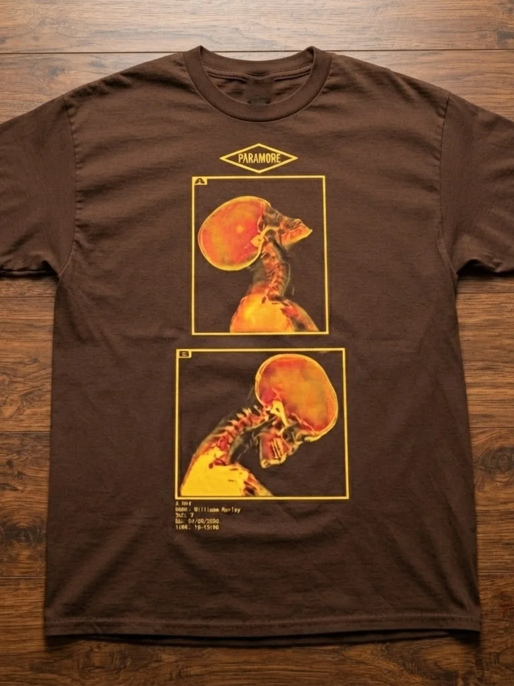 Paramore Brown Graphic Band Tee - Yellow/Orange Skull X-Ray